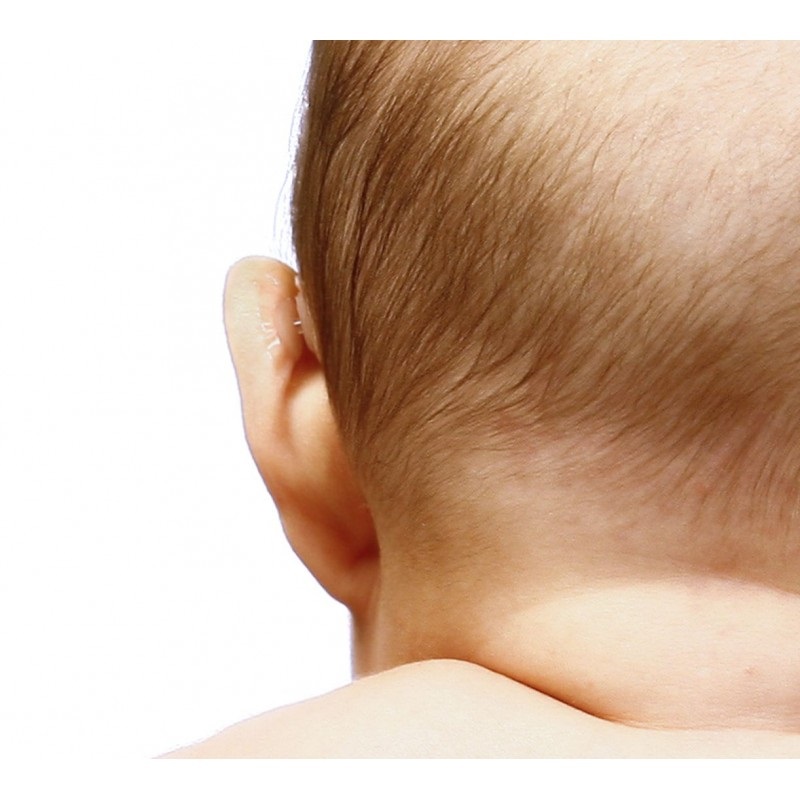 Obrázok OTOSTICK Baby Korektor odstávajúcich uší pre deti 8 ks