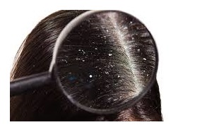 Obrázok BIODERMA Nodé DS+ šampón proti lupinám 125 ml