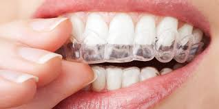 Obrázok WHITE PEARL Systém na bielenie zubov 130 ml